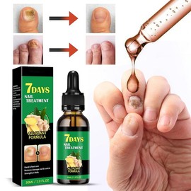 Ginger Nail Treatment Nail Support Nail Care, Nail Oil for Growth and Strength, Nail Growth Oil, Cuticle Oil for Nails, Nail Aid Keratin 3 Day Growth -  Repair & Strengthen (1 pc) ginger nail serum Ginger Nail - Specification: 1 PC