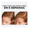 3 Pack Shampoo, Acondic + Serum Aminexil Anticaida Loreal