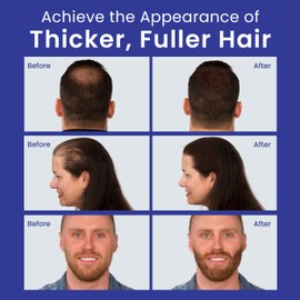 INFINITY Hair Fibers Grey for Thinning Hair for Women & Men - 100% Undetectable Hair Building Fiber Powder - Conceal Hair Loss in 15 Seconds, 15g