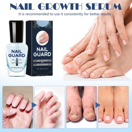 2 piezas de suero para el crecimiento y la reparación de uñas Onyxoguard, Onyx Guard Nail, suero Onyxoguard, fortalecedor de uñas F