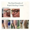 Cream, Growth Factor Skin Repair For Cracked Heels, Hands,