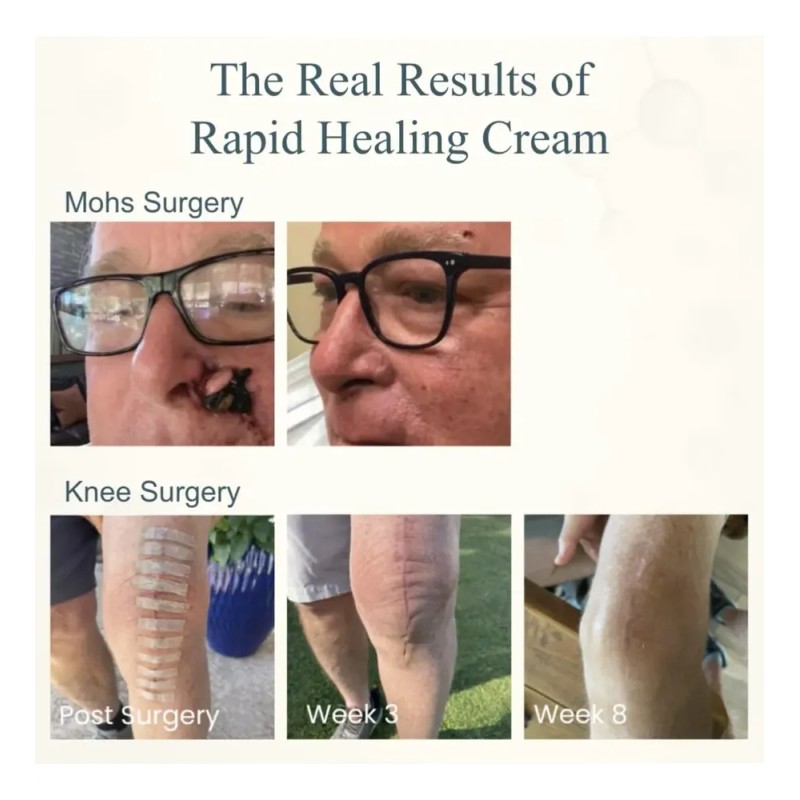 Cream, Growth Factor Skin Repair For Cracked Heels, Hands,