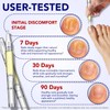 4Pcs Nail Care Pens, Moisturizing Nail Strengthener for Discoloured Nails