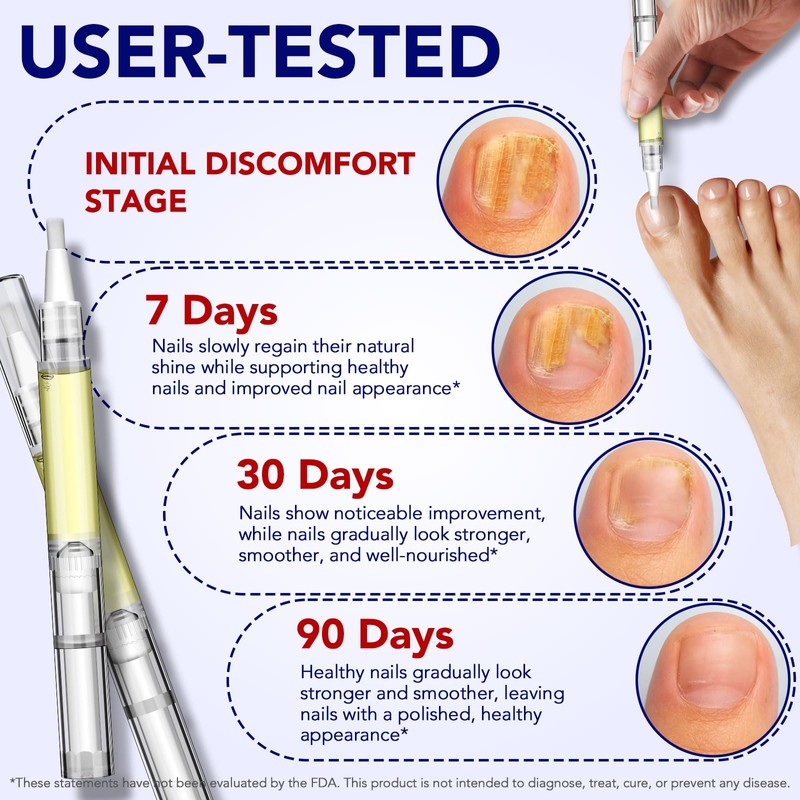 4Pcs Nail Care Pens, Moisturizing Nail Strengthener for Discoloured Nails