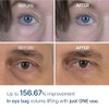 Dr.Melaxin Eyephalt Eyebag Cream 10ml