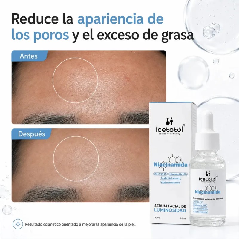 Icetotol - Suero Facial Niacinamida 10% Zinc PCA 1% Icetotol