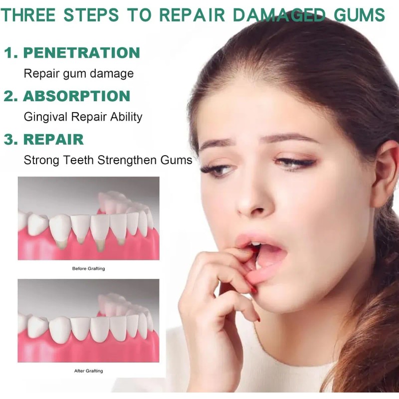 Gotas Restauradoras Encías