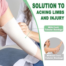 Elastic Tubular Support Bandage, Stockinette Tubing for Arm, Legs, Knees, Compression Tube Bandage Roll for Tissue Support 3.6" x 11 yd (Size E)