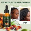Wh Sérum Para El Crecimiento Del Cabello Rihako Batana Oil
