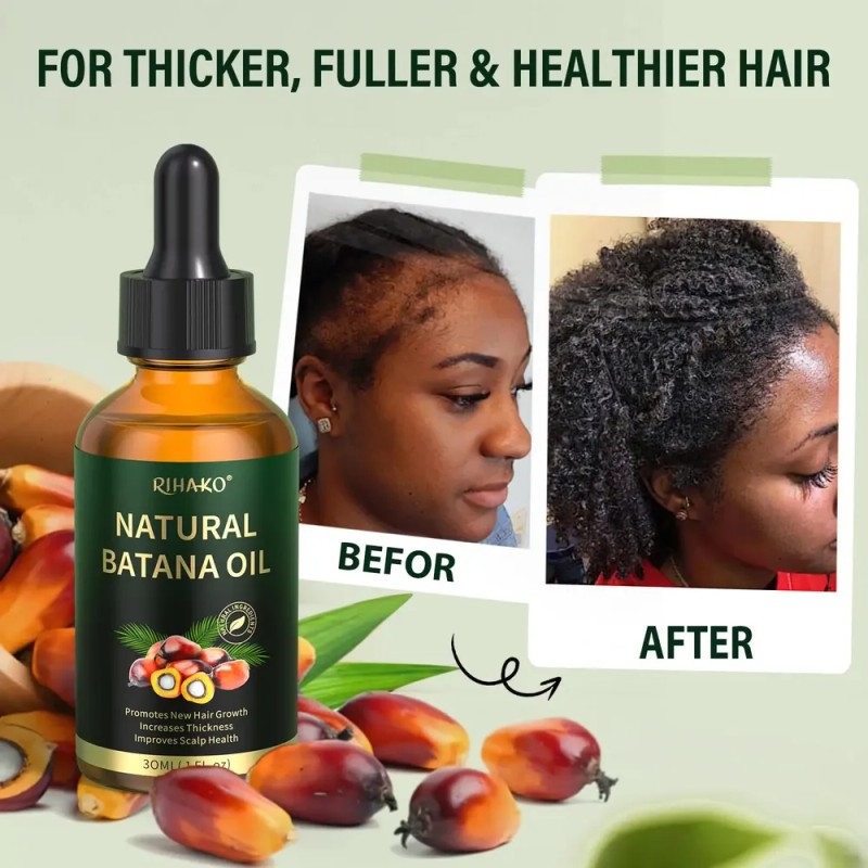 Wh Sérum Para El Crecimiento Del Cabello Rihako Batana Oil