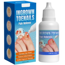 Ingrown Toenail Treatment, Ingrowing Toenail Treatment Extra-Strong, Ingrown Nail Treatments for Toenails, 20ml