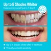 Cali White Teeth Whitening Strip Kit with LED Light and