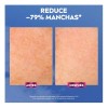 Nivea Luminous 630 Sérum Facial Anti-Manchas e Imperfecciones, 30 ml