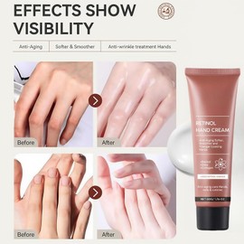 Retinol Hand Cream,Firming Anti-Aging Hand Lotion,Retinol Hand Cream Anti Aging,Hand Repair Cream,Retinol Moisturizer Cream,Soft & Supple Hands,Travel Size Hand Lotion,Suitable for Dry Skin