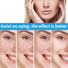 Crema para Manchas Oscuras en La Cara, Cremas para Quitar
