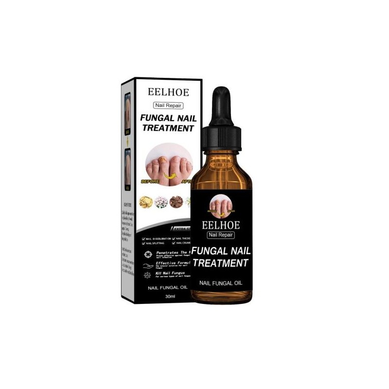 손톱 에센스 리페어 발톱 [9] Nail Essence Repair Toe Nails