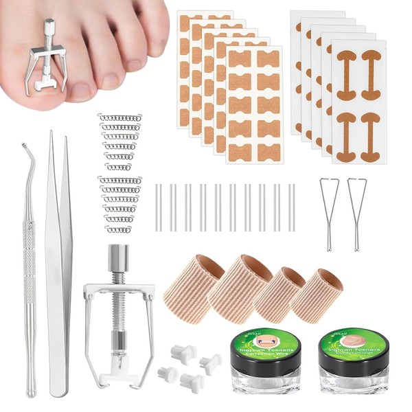 Ingrown Toenails Set Toenail Ingrown Correction Nail Correction Clip Ingrown