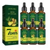 /6el Aceite Capilar Ginger King Nutre Los Folículos Pilosos.