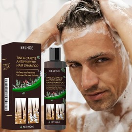 Anti-Dandruff Shampoo anti-itching for Men & Women, with Fresh Scent , Tinea Capitis Scalp Treatment & Cleansing Healthy 3.38 FL OZ Cleanser Conditioner Haircare cleanser comfort - Specification: 3pcs