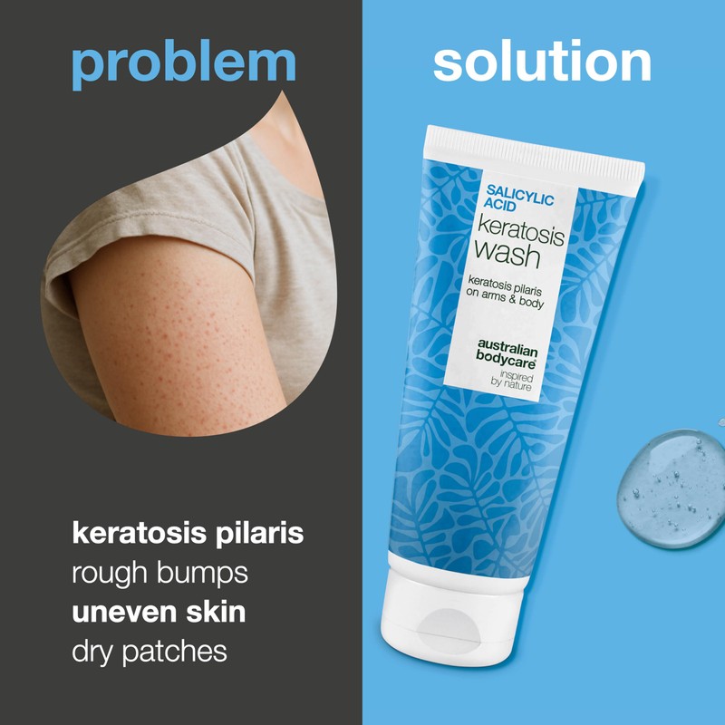 Keratosis Pilaris Body Wash – Targets Bumpy Skin, Strawberry Legs