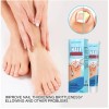 Tt/ Crema Fungicida Para Hongos En Uñas Y Piel De