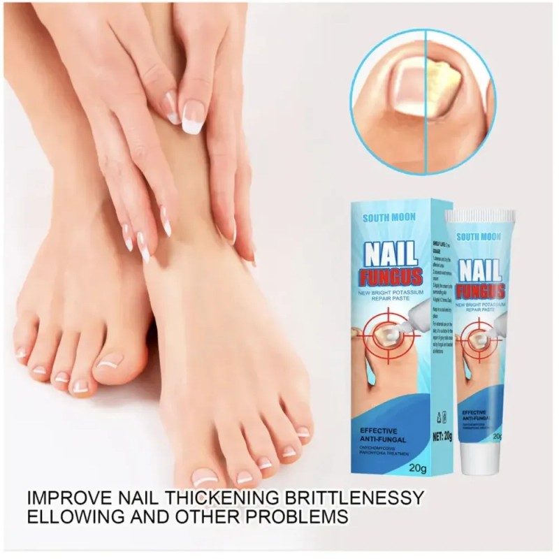 Tt/ Crema Fungicida Para Hongos En Uñas Y Piel De