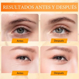 LUSCOR 2PCS Crema para Ojos de papa,Crema de ojos anti-wrinking péptido 5D，Crema para Ojos Peptidos 5D Antiarrugas，Reduce bolsas y ojeras, Repara el contorno de ojos, 15 ml