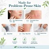 PURESKIN Sulfur & Tea-Tree-Oil Soap Bar: Natural Deep Cleansing for