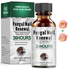 30ml Nagelpflege Behandlung, Nail Repair, Schutz Stärkung brüchiger Nägel, Fingernägel und Fußnägel für Nail Care, Schnell Wirkendes Nagelpflege Pflegend