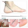 Samcos Exfoliating Fish Eye Removal, Stainless Steel Foot Care Set,