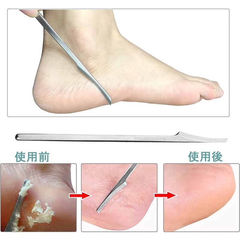 Samcos Exfoliating Fish Eye Removal, Stainless Steel Foot Care Set,