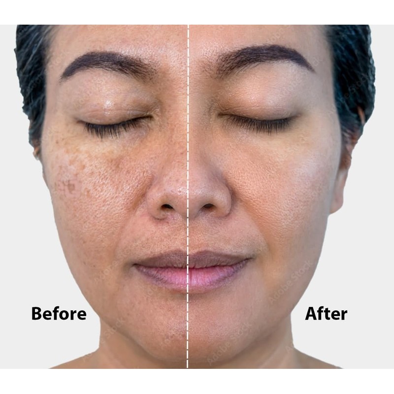 Sule Beauty Vitamin C Face Serum – Powered by 20%