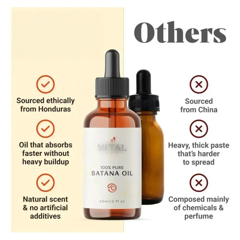 Y* Lh 1 Pieza - Aceite Capilar Vital Batana Oil