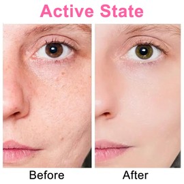 Vxcbad 4 Rolls Face Tape Lifting Face Lifting Tape Wrinkle Tape Face Patches Face Tape Against Wrinkles 2.5 cm x 5 m