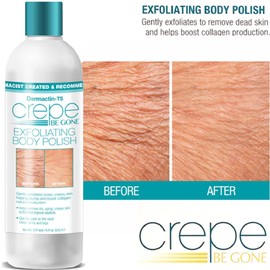 Dermactin-TS Crepe Be Gone Ultimate Crepe Skin Solution Collection - 6-PC Set