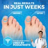 Pedicure Quality Foot Soak – Tea Tree Oil & Epsom