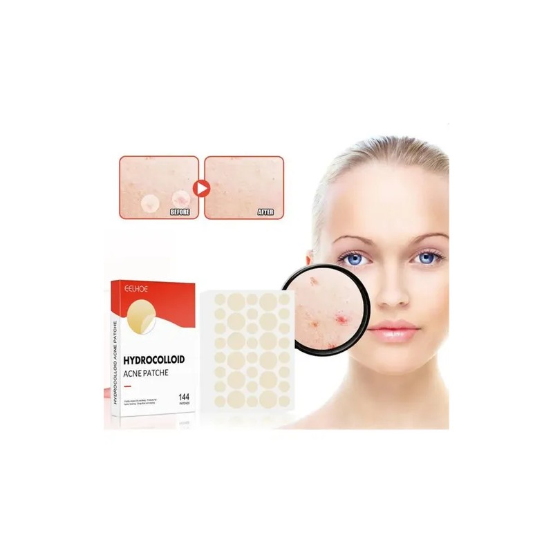 Parches Hidrocoloide Antiacné 144pzs Dia Y Noche 2 Medidas