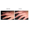 Scar Treatment Gel, 30g