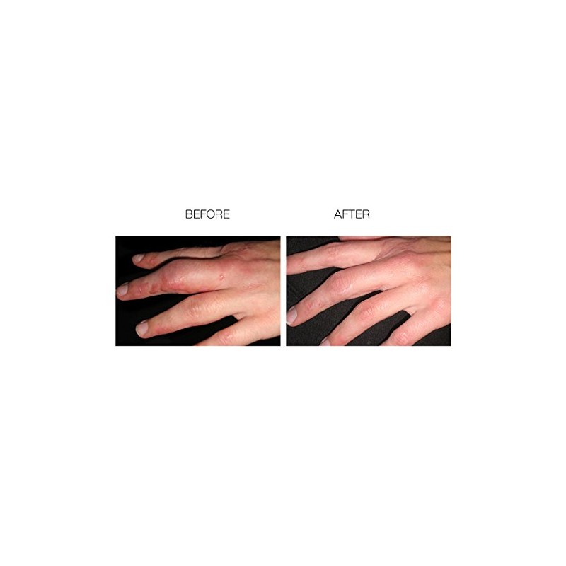 Scar Treatment Gel, 30g