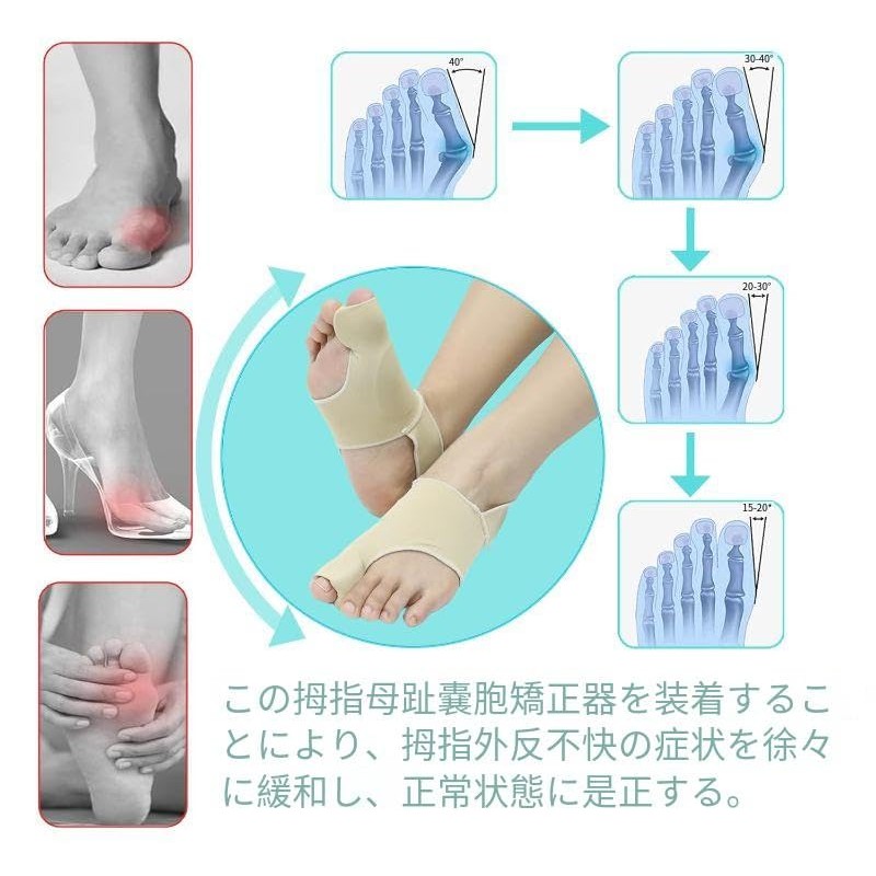 SATiNU Bunion Supporter, Toe Pad, Anti-bunions (L, Beige)