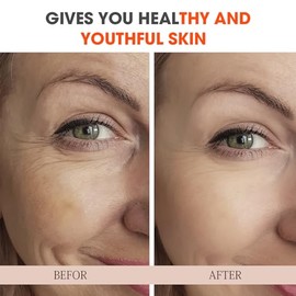 Suero súper vitamina C para mujeres mayores de 70 años, paquete total todo en uno, suero facial para piel madura, hidratante, levantamiento, antienvej