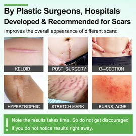 Silicone Scar Sheets(1.8” x 157”Inch- 4M), Scar Tape, Scar Strips, Medical Grade, Scar Remover, C-Section, Surgery, Keloid, Tummy Tuck, Scar Patch.
