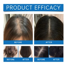 2pcs Scalp Cooling Hair Ampoule, Scalp Serum, Scalpy Hair Growth Serum for Men & Women, Hair Strengthen & Grow