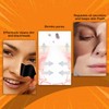 Charcoal Nose Patch, Blackhead Removal Strips, 10 Pack, Deep Cleansing