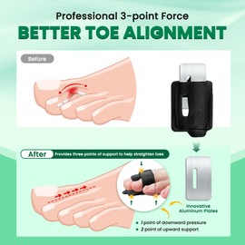 TASZOOS Hammer Toe Straightener Corrector for Women & Men - 4 Pcs Broken Toe Wraps Splint Relief for Curled, Hammer, Crooked, Broken Support (Black)