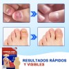Culdsnia Parches Para Uñas Fúngicos De Parches 42 Pcs /