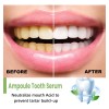 Pacote De 5 Séruns Clareadores De Dentes Eel