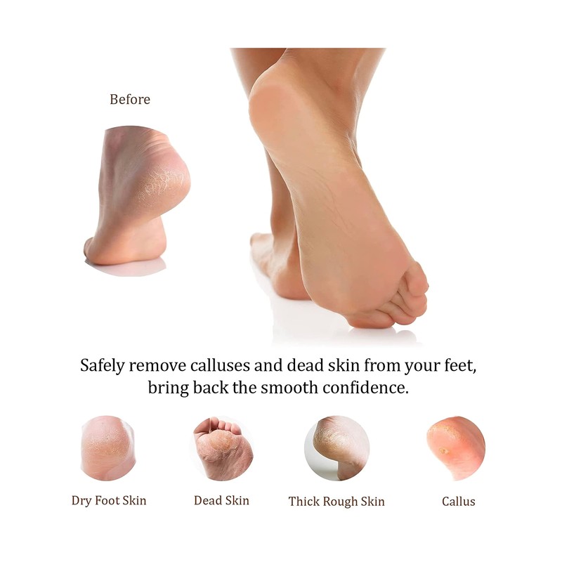 Foot File Callus Remover for Feet - Double Sided Emery