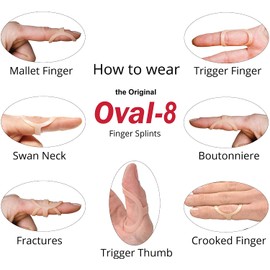 3-Point Products Oval-8 Finger Splint, Support and Protection for Arthritis, Trigger Finger or Thumb, and Other Finger Conditions, 3-Pack, Size 10