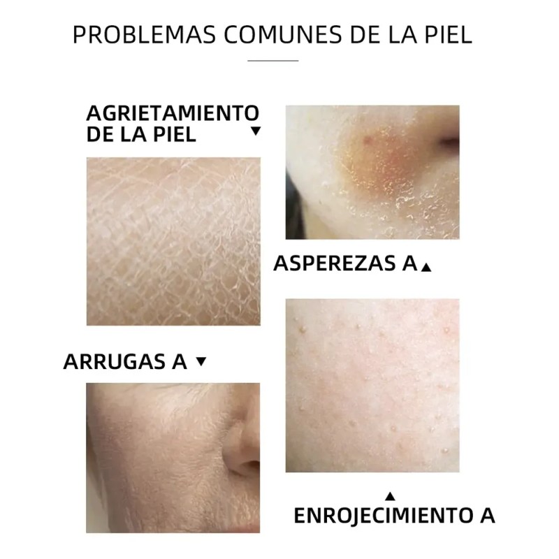 Crema Facial De Aguacate, Base En Crema For Nieve